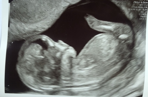 November 2020 Babies - Thread 6!