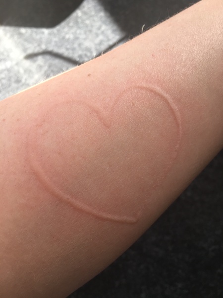 I can make a rash on my body if I scratch myself