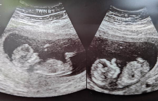 November 2020 Babies - Thread 6!