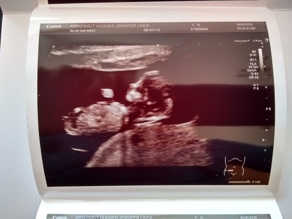 November 2020 Babies - Thread 5