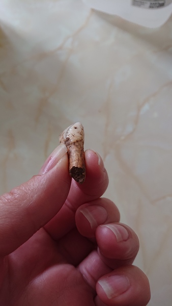 Who's tooth is this??