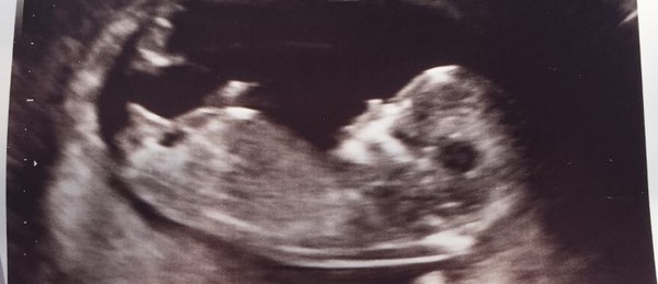Any guesses on gender?? :)