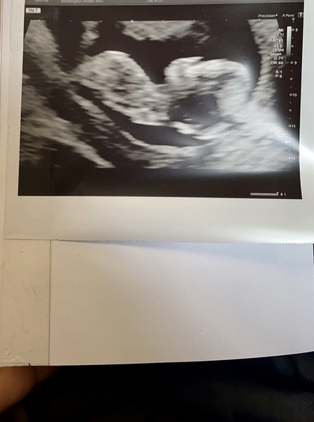 November 2020 Babies - Thread 6!