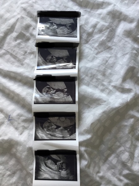 November 2020 Babies - Thread 6!