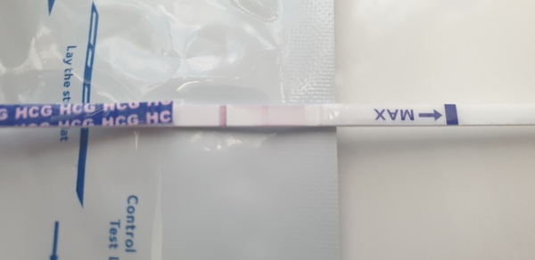 Pregnancy after MMC