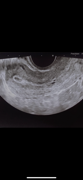 5 weeks pregnant!