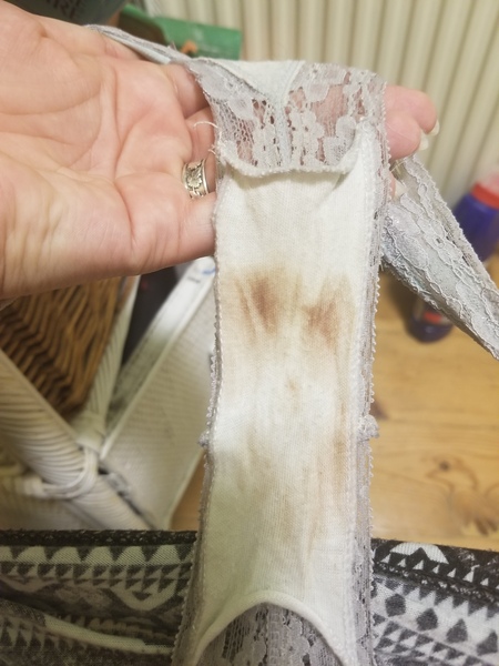 TMI - Inplantation bleeding or not?