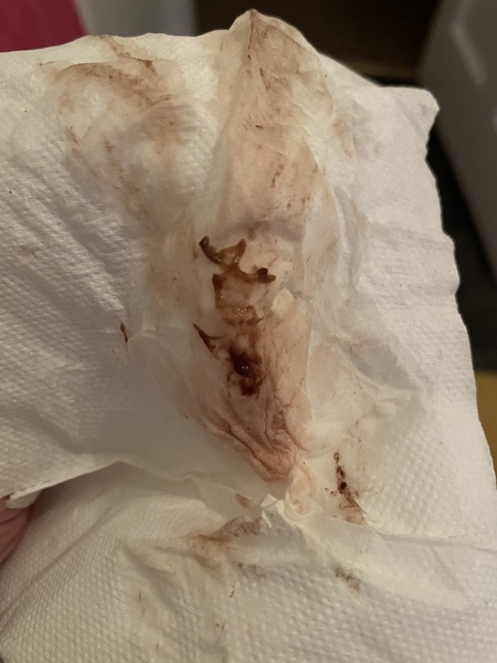 (Pic attached - don’t open if sensitive) Periods have gone wonky