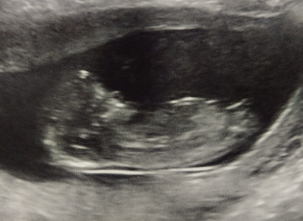 Christmas babies thread 3!
