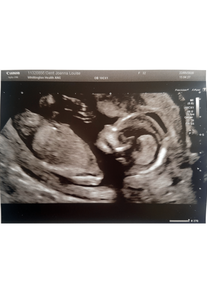 November 2020 babies - thread 7!