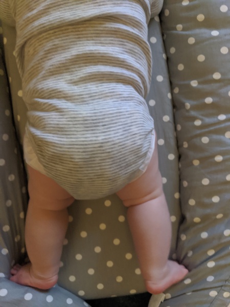 AIBU to ask if your baby's leg fat folds are symmetrical?!