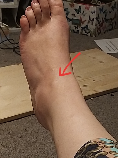 Stoopid Foot