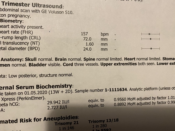 12 week scan - worrying over nothing?