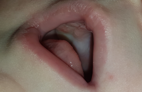 Teething maybe?
