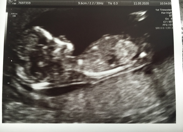 November 2020 Babies - Thread 6!