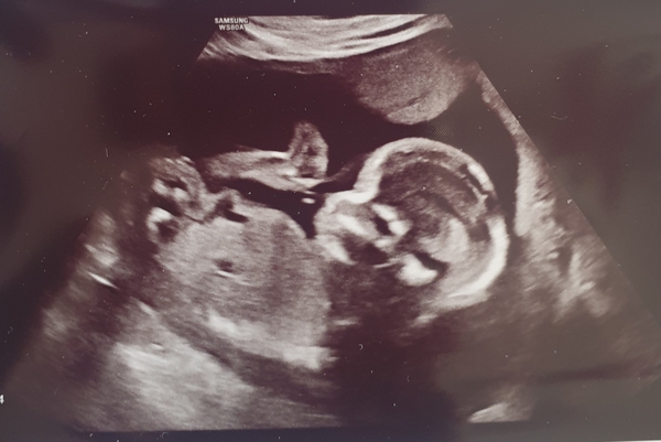 Early Oct babies part 5