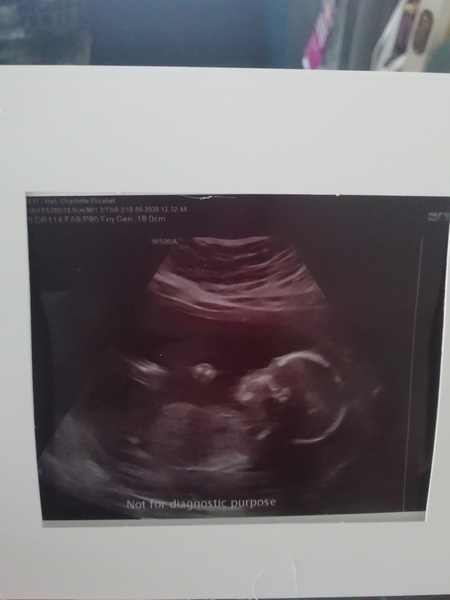 Early Oct babies part 4