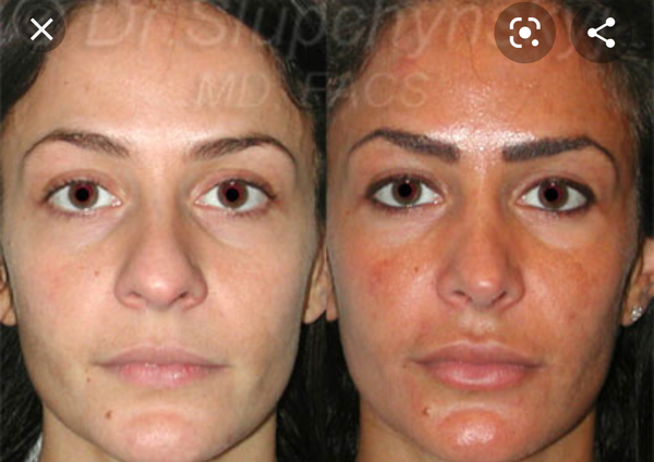 To not like my nose and want a nose job