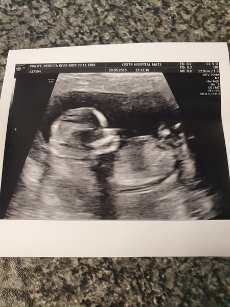 Boy or girl?