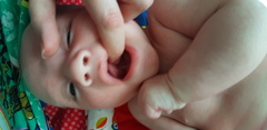Tongue tie?