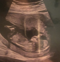 Gender guess please??