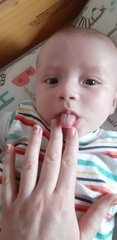 Tongue tie?