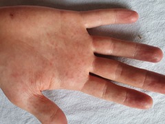 Does anyone know what these spots are please?