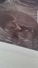 Gender predictions!!