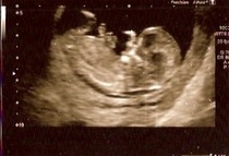 12 week scan guesses - just for fun!