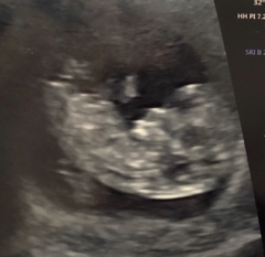 Gender guesses