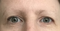 Growing back eyebrows