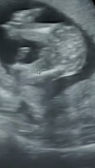 Told wrong gender at ultrasound??