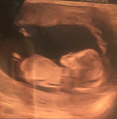 Gender guess please??