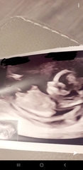 Boy or girl guesses for fun?