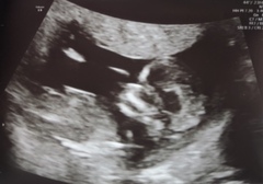Gender guesses