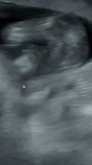 Told wrong gender at ultrasound??