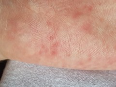 Does anyone know what these spots are please?