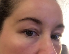 Growing back eyebrows
