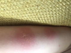 Can anyone help identify these bites