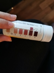 Very high ketone in urine