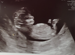 Thread for us classed as mature pregnant ladies