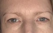 Growing back eyebrows