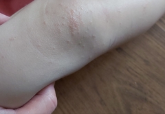 Whats this on DD's knees?
