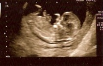 12 week scan time ladies 👣 Pregnancies due Late November/December
