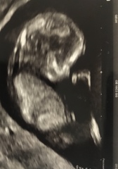 Guess boy or girl