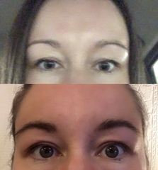 Growing back eyebrows