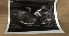 Boy or girl please guess 💜💙