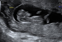 Due end of November Early December 👣