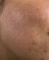 Any ideas as to what's up with my skin? ...Images included.