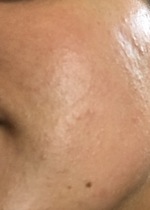 Any ideas as to what's up with my skin? ...Images included.